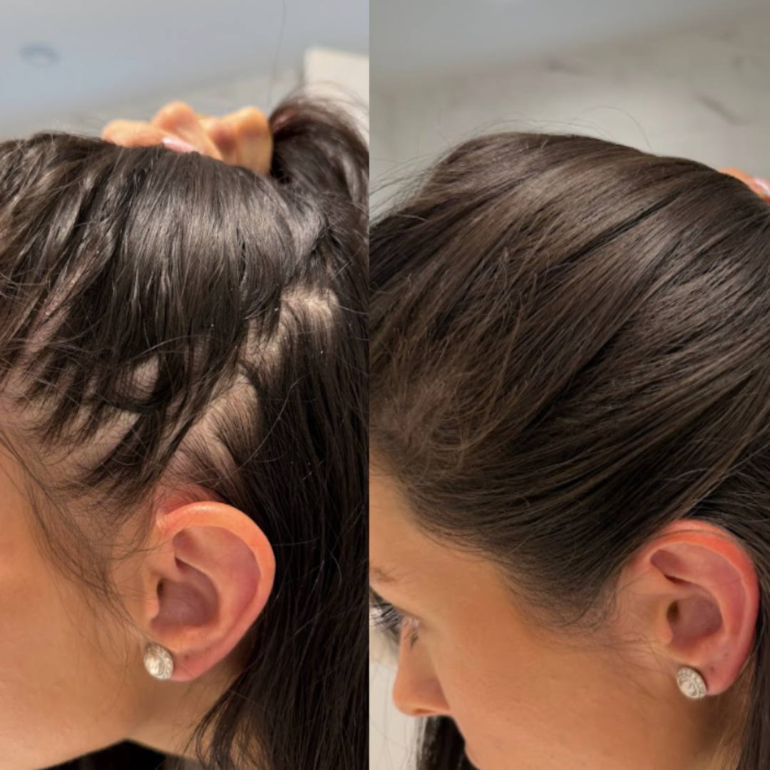Density Boosting Hair Set