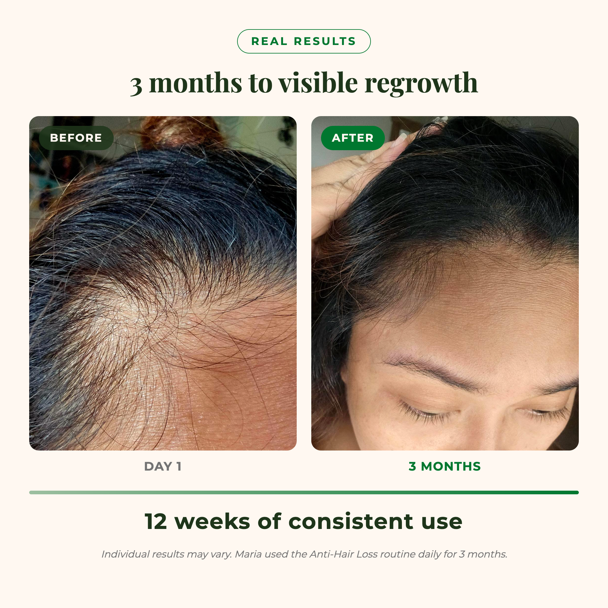 Density Boosting Hair Set
